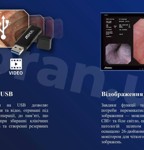 Гастростійка, ендоскопічна стійка для колоноскопії, стійка для бронхоскопії